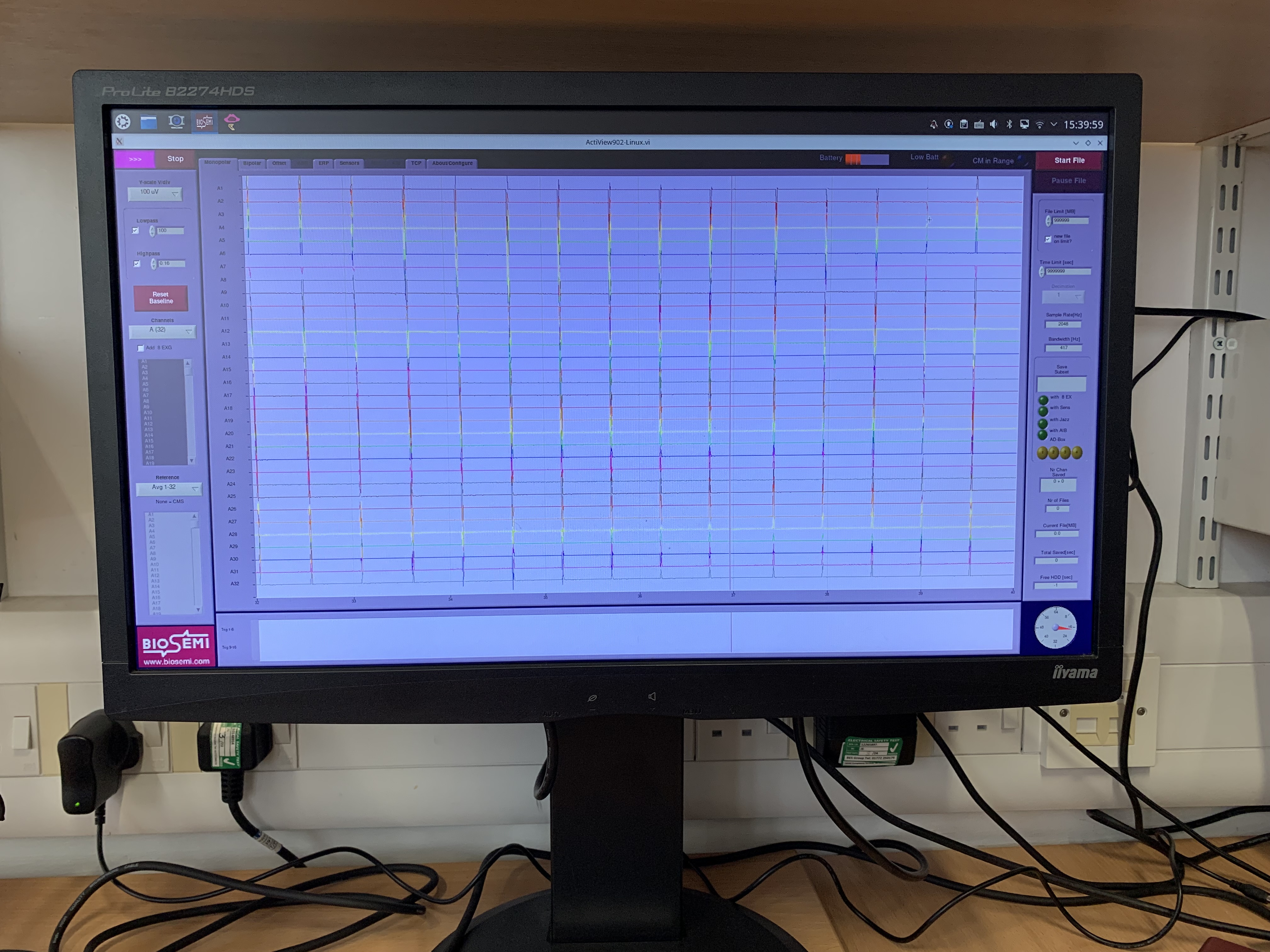 EEG signal